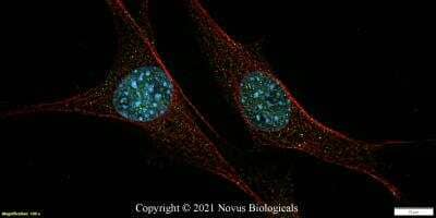 Immunocytochemistry/Immunofluorescence: 53BP1 Antibody (6B3E10) - Azide and BSA Free [NBP2-80549] - NIH3T3 cells were fixed in 4% paraformaldehyde for 10 minutes and permeabilized in 0.5% Triton X-100 in PBS for 5 minutes. The cells were incubated with anti-53BP1 Antibody [6B3E10] NBP2-80549 at 2 ug/ml overnight at 4C and detected with an anti-mouse DyLight 488 (Green) at a 1:1000 dilution for 60 minutes.  Beta tubulin NB600-936 was used as a co-stain at a 1:1000 dilution and detected with an anti-rabbit DyLight 550 (Red) at a 1:1000 dilution. Nuclei were counterstained with DAPI (Blue).  Cells were imaged using a 100X objective and digitally deconvolved.