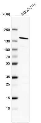 Western Blot: 53BP1 Antibody [NBP2-54659] - Western blot analysis of human cell line SCLC-21H, blotted with 53BP1 Antibody. The molecular weight is observed at ~160 kDa and the theoretical molecular weight of the endogenous protein is 214 kDa.