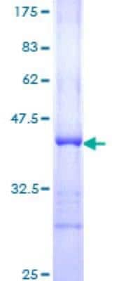 SDS-PAGE Recombinant Human 53BP1 GST (N-Term) Protein