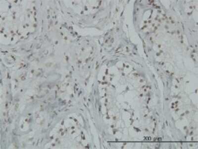 Immunohistochemistry-Paraffin: 53BP2 Antibody (3F8) [H00007159-M01] - Analysis of monoclonal antibody to TP53BP2 on formalin-fixed paraffin-embedded human testis. Antibody concentration 3 ug/ml.