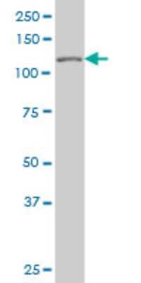 Western Blot: 53BP2 Antibody (3F8) [H00007159-M01] - TP53BP2 monoclonal antibody (M01), clone 3F8 Analysis of TP53BP2 expression in HepG2.