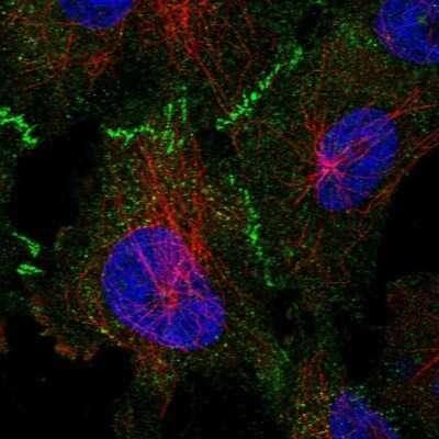 Immunocytochemistry/Immunofluorescence: 53BP2 Antibody [NBP2-58677] - Staining of human cell line U-251 MG shows localization to cytosol & cell junctions.