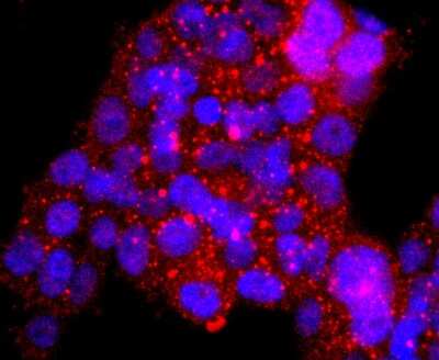 Immunocytochemistry/Immunofluorescence: 53BP2 Antibody (JF09-98) [NBP2-67094] - Staining ASPP2 in 293T cells (red). The nuclear counter stain is DAPI (blue). Cells were fixed in paraformaldehyde, permeabilised with 0.25% Triton X100/PBS.