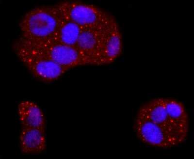 Immunocytochemistry/Immunofluorescence: 53BP2 Antibody (JF09-98) [NBP2-67094] - Staining ASPP2 in Hela cells (red). The nuclear counter stain is DAPI (blue). Cells were fixed in paraformaldehyde, permeabilised with 0.25% Triton X100/PBS.