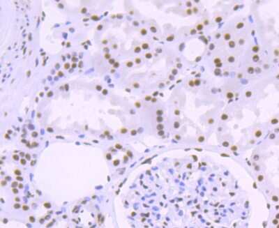 Immunohistochemistry-Paraffin: 53BP2 Antibody (JF09-98) [NBP2-67094] - Analysis of paraffin-embedded human kidney tissue using anti-ASPP2 antibody. Counter stained with hematoxylin.