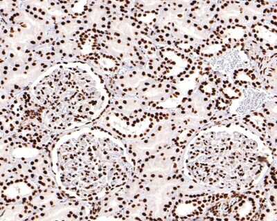 Immunohistochemistry-Paraffin: 53BP2 Antibody (JF09-98) [NBP2-67094] - Analysis of paraffin-embedded human kidney tissue using anti-53BP2 antibody. The section was pre-treated using heat mediated antigen retrieval with sodium citrate buffer (pH 6.0) for 20 minutes. The tissues were blocked in 1% BSA for 30 minutes at room temperature, washed with ddH2O and PBS, and then probed with the primary antibody (1/400) for 30 minutes at room temperature. The detection was performed using an HRP conjugated compact polymer system. DAB was used as the chromogen. Tissues were counterstained with hematoxylin and mounted with DPX.