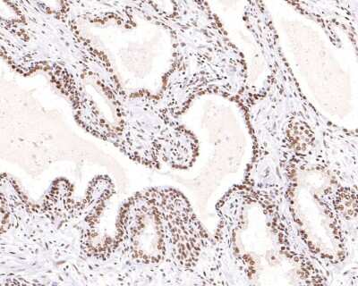 Immunohistochemistry-Paraffin: 53BP2 Antibody (JF09-98) [NBP2-67094] - Analysis of paraffin-embedded human prostate tissue using anti-53BP2 antibody. The section was pre-treated using heat mediated antigen retrieval with sodium citrate buffer (pH 6.0) for 20 minutes. The tissues were blocked in 1% BSA for 30 minutes at room temperature, washed with ddH2O and PBS, and then probed with the primary antibody 1/100) for 30 minutes at room temperature. The detection was performed using an HRP conjugated compact polymer system. DAB was used as the chromogen. Tissues were counterstained with hematoxylin and mounted with DPX.
