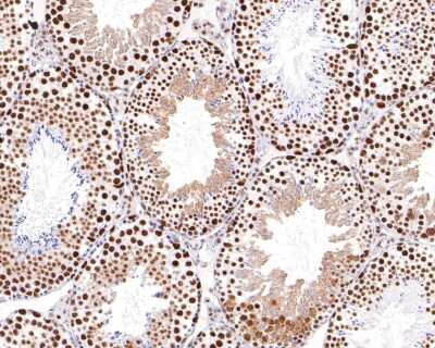 Immunohistochemistry-Paraffin: 53BP2 Antibody (JF09-98) [NBP2-67094] - Analysis of paraffin-embedded mouse testis tissue using anti-53BP2 antibody. The section was pre-treated using heat mediated antigen retrieval with sodium citrate buffer (pH 6.0) for 20 minutes. The tissues were blocked in 1% BSA for 30 minutes at room temperature, washed with ddH2O and PBS, and then probed with the primary antibody (1/400) for 30 minutes at room temperature. The detection was performed using an HRP conjugated compact polymer system. DAB was used as the chromogen. Tissues were counterstained with hematoxylin and mounted with DPX.