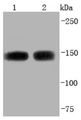 Western Blot: 53BP2 Antibody (JF09-98) [NBP2-67094] - Analysis of ASPP2 on different lysates using anti-ASPP2 antibody at 1/1,000 dilution. Positive control: Lane 1: Hela Lane 2: MCF-7
