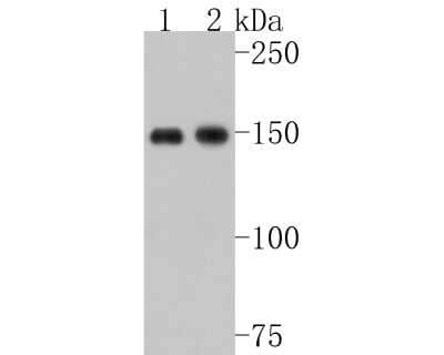 Western Blot: 53BP2 Antibody (JF09-98) [NBP2-67094] - Analysis of 53BP2 on different lysates. Proteins were transferred to a PVDF membrane and blocked with 5% BSA in PBS for 1 hour at room temperature. The primary antibody (1/500) was used in 5% BSA at room temperature for 2 hours. Goat Anti-Rabbit IgG - HRP Secondary Antibody at 1:200,000 dilution was used for 1 hour at room temperature. Positive control: Lane 1: Hela cell lysate Lane 2: MCF-7 cell lysate