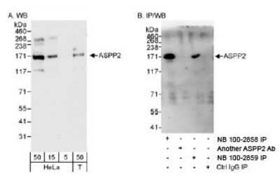 Western Blot 53BP2 Antibody