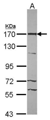 Western Blot: 53BP2 Antibody [NBP2-21589] - Sample (30 ug of whole cell lysate) A: NT2D1 7. 5% SDS PAGE gel, diluted at 1:1000.