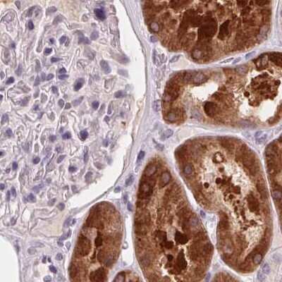 Immunohistochemistry-Paraffin: 58K Golgi Protein Antibody [NBP2-48600] - Staining of human kidney.