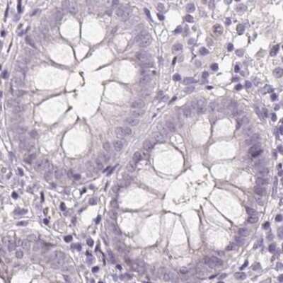 Immunohistochemistry-Paraffin: 58K Golgi Protein Antibody [NBP2-48600] - Staining of human colon.