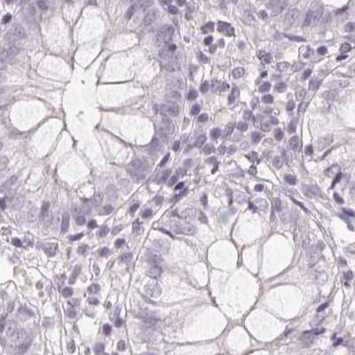 Immunohistochemistry-Paraffin: 58K Golgi Protein Antibody [NBP2-48601] - Staining of human colon.