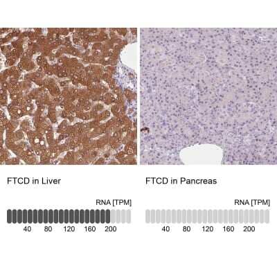 Immunohistochemistry-Paraffin: 58K Golgi Protein Antibody [NBP2-48651] - Staining in human liver and pancreas tissues using anti-FTCD antibody. Corresponding FTCD RNA-seq data are presented for the same tissues.