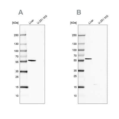 <b>Independent Antibodies Validation. </b>Western Blot: 58K Golgi Protein Antibody [NBP2-48601] - Analysis using Anti-FTCD antibody NBP2-48601 (A) shows similar pattern to independent antibody NBP2-48600 (B).