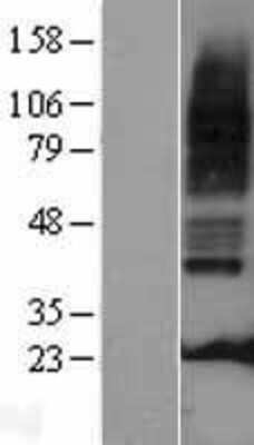 Western Blot: 5HT3A receptor Overexpression Lysate (Adult Normal) [NBP2-10718] Left-Empty vector transfected control cell lysate (HEK293 cell lysate); Right -Over-expression Lysate for 5HT3A receptor.
