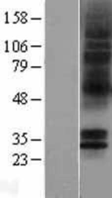 Western Blot: 5HT5A receptor Overexpression Lysate (Adult Normal) [NBP2-04394] Left-Empty vector transfected control cell lysate (HEK293 cell lysate); Right -Over-expression Lysate for 5HT5A receptor.