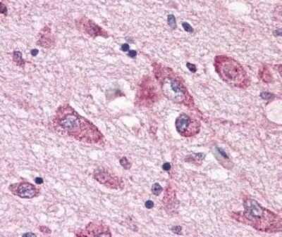 Immunohistochemistry: 5HT7 Receptor Antibody [NLS6675] - IHC analysis of Brain, neurons and glia using NLS6675 at 2 ug/ ml.