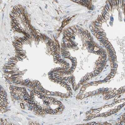 Immunohistochemistry: 5T4 Antibody [NBP1-90315] - Staining of human seminal vesicle shows strong membranous positivity in glandular cells.