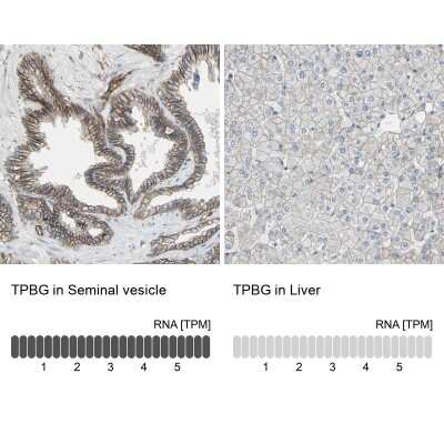 Immunohistochemistry-Paraffin: 5T4 Antibody [NBP1-90315] - Analysis in human seminal vesicle and liver tissues. Corresponding 5T4 RNA-seq data are presented for the same tissues.
