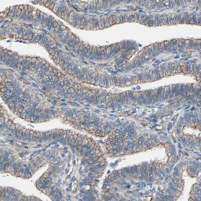 Immunohistochemistry-Paraffin: 5T4 Antibody [NBP1-90315] - Staining of human fallopian tube shows moderate membranous positivity in glandular cells.