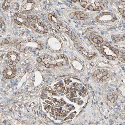 Immunohistochemistry-Paraffin: 5T4 Antibody [NBP1-90315] - Staining of human kidney shows moderate membranous positivity in cells in tubules.