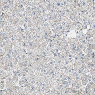 Immunohistochemistry-Paraffin: 5T4 Antibody [NBP1-90315] - Staining of human liver shows weak membranous positivity in hepatocytes as expected.