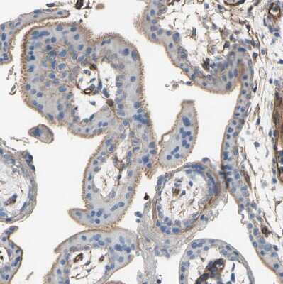 Immunohistochemistry-Paraffin: 5T4 Antibody [NBP1-90315] - Staining of human placenta shows moderate membranous positivity in trophoblastic cells.