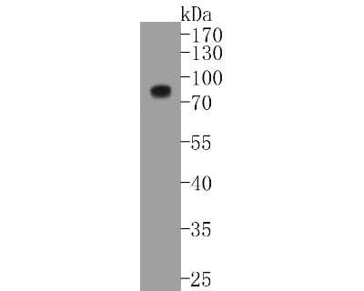Western Blot: 5T4 Antibody (SU34-05) [NBP2-67470] - Western blot analysis of 5T4 on MCF-7 cell lysates. Proteins were transferred to a PVDF membrane and blocked with 5% BSA in PBS for 1 hour at room temperature. The primary antibody (1/500) was used in 5% BSA at room temperature for 2 hours. Goat Anti-Rabb