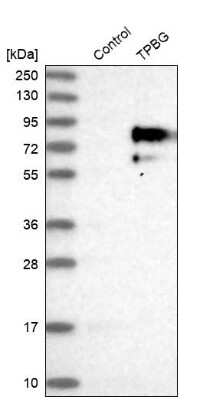 Western Blot: 5T4 Antibody [NBP1-90315] - Analysis in control (vector only transfected HEK293T lysate) and TPBG over-expression lysate (Co-expressed with a C-terminal myc-DDK tag (3.1 kDa) in mammalian HEK293T cells).