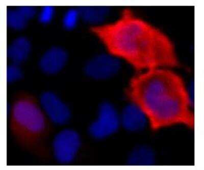 Immunocytochemistry/Immunofluorescence: 6-Histidine Epitope Tag Antibody (HIS.H8) [DyLight 550] [NBP2-31055R] - analysis of HeLa cells transfected with a construct containing a 6x-His Epitope Tag. Formalin fixed cells were permeabilized with 0.1% Triton X-100 in TBS for 10 minutes at room temperature and blocked with 1% Blocker BSA  for 15 minutes at room temperature. Cells were probed with a DyLight 550-conjugated 6x-His Epitope Tag monoclonal antibody at a dilution of 1:25 for at least 1 hour at room temperature. Nuclei (blue) were stained with Hoechst 33342 dye. Images were taken on a Thermo Scientific ArrayScan or ToxInsight Instrument at 20X magnification.