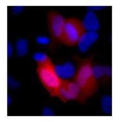 Immunocytochemistry/Immunofluorescence: 6-Histidine Epitope Tag Antibody (HIS.H8) [DyLight 650] [NBP2-31055C] - analysis of HeLa cells transfected with a construct containing a 6x-His Epitope Tag. Formalin fixed cells were permeabilized with 0.1% Triton X-100 in TBS for 10 minutes at room temperature and blocked with 1% Blocker BSA  for 15 minutes at room temperature. Cells were probed with a DyLight 650-conjugated 6x-His Epitope Tag monoclonal antibody at a dilution of 1:25 for at least 1 hour at room temperature. Nuclei (blue) were stained with Hoechst 33342 dye. Images were taken on a Thermo Scientific ArrayScan or ToxInsight Instrument at 20X magnification.