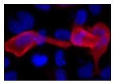Immunocytochemistry/Immunofluorescence: 6-Histidine Epitope Tag Antibody (HIS.H8) [DyLight 680] [NBP2-31055FR] - analysis of HeLa cells transfected with a construct containing a 6x-His Epitope Tag. Formalin fixed cells were permeabilized with 0.1% Triton X-100 in TBS for 10 minutes at room temperature and blocked with 1% Blocker BSA  for 15 minutes at room temperature. Cells were probed with a DyLight 680-conjugated 6x-His Epitope Tag monoclonal antibody at a dilution of 1:25 for at least 1 hour at room temperature. Nuclei (blue) were stained with Hoechst 33342 dye. Images were taken on a Thermo Scientific ArrayScan or ToxInsight Instrument at 20X magnification.