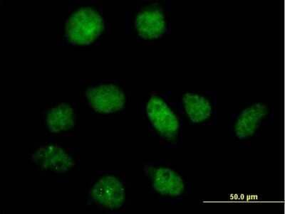 Immunocytochemistry/Immunofluorescence: 6 Phosphofructo 2 Kinase Antibody [H00005209-B01P] - Analysis of purified antibody to PFKFB3 on HeLa cell. (antibody concentration 10 ug/ml)