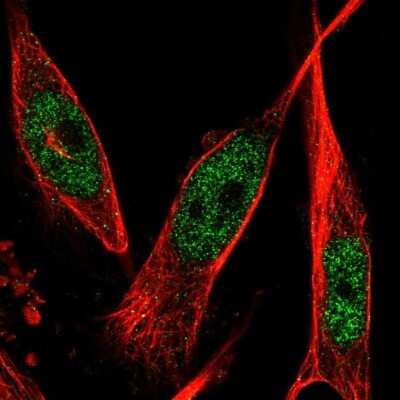 <b>Orthogonal Strategies Validation. </b>Immunocytochemistry/Immunofluorescence: 6 Phosphofructo 2 Kinase Antibody [NBP1-87478] - Staining of human cell line U-251 MG shows positivity in nucleus but excluded from the nucleoli. Antibody staining is shown in green.