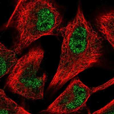 Immunocytochemistry/Immunofluorescence: 6 Phosphofructo 2 Kinase Antibody [NBP2-55403] - Staining of human cell line A549 shows localization to nucleoplasm.