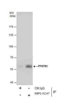 Immunoprecipitation: 6 Phosphofructo 2 Kinase Antibody [NBP1-31147] - Immunoprecipitation of PFKFB3 protein from A431 whole cell extracts using 5 ug of PFKFB3 antibody [C3], C-term. Western blot analysis was performed using PFKFB3 antibody [C3], C-term. EasyBlot anti-Rabbit IgG  was used as a secondary reagent.