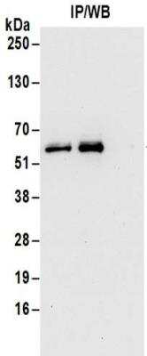 Immunoprecipitation: 6 Phosphofructo 2 Kinase Antibody [NBP2-32162] - Whole cell lysate (0.5 to 1.0 mg per IP reaction; 20% of IP loaded) from Jurkat cells.  Antibodies:  Affinity purified rabbit anti-6 Phosphofructo 2 Kinase antibody NBP2-32162 used for IP at 6 ug per reaction. For blotting immunoprecipitated 6 Phosphofructo 2 Kinase was used at 1 ug/ml.  Detection: Chemiluminescence with an exposure time of 30 seconds.