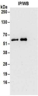 <b>Biological Strategies Validation. </b>Immunoprecipitation: 6 Phosphofructo 2 Kinase Antibody [NBP2-32163] - Samples:  Whole cell lysate (0.5 to 1.0 mg per IP reaction; 20% of IP loaded) from Jurkat cells.  Antibodies:  Affinity purified rabbit anti-6 Phosphofructo 2 Kinase antibody NBP2-32163 used for IP at 6 ug per reaction. For blotting immunoprecipitated 6 Phosphofructo 2 Kinase, NBP2-32163 was used at 1 ug/ml.  Detection: Chemiluminescence with an exposure time of 30 seconds.