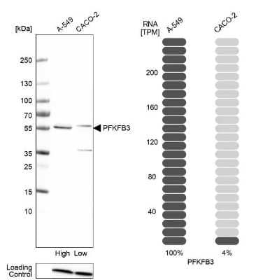Western Blot: 6 Phosphofructo 2 Kinase Antibody [NBP1-87478] - Analysis in human cell line A-549 and human cell line CACO-2.