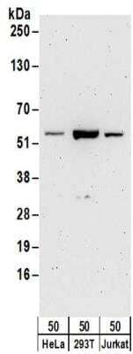 Western Blot: 6 Phosphofructo 2 Kinase Antibody [NBP2-32163] - Samples:  Whole cell lysate (50 ug) from HeLa, 293T, and Jurkat cells.  Antibodies:  Affinity purified rabbit anti-6 Phosphofructo 2 Kinase antibody NBP2-32163 used for WB at 0.1 ug/ml.  Detection: Chemiluminescence with an exposure time of 3 minutes.