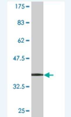 Western Blot: 60S ribosomal protein L23 Antibody (2F12) [H00009349-M01] -  Detection against Immunogen (34.21 KDa) .