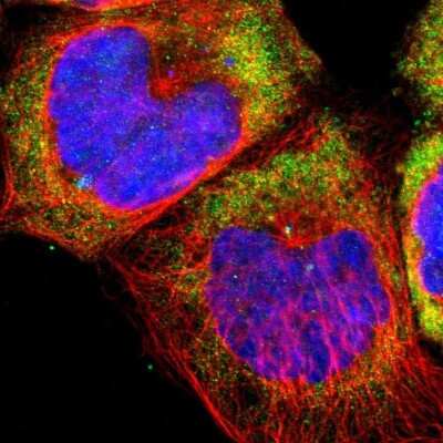 Immunocytochemistry/Immunofluorescence: 60S ribosomal protein L23 Antibody [NBP1-87847] - Immunofluorescent staining of human cell line A-431 shows localization to cytosol.