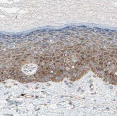 Immunohistochemistry-Paraffin: 60S ribosomal protein L23 Antibody [NBP1-87847] - Staining of human kink shows weak to moderate cytoplasmic positivity in squamous epithelial cells.