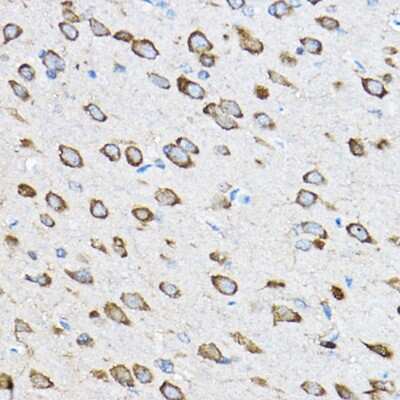 Immunohistochemistry-Paraffin: 60S ribosomal protein L23 Antibody [NBP2-92441] - Immunohistochemistry of paraffin-embedded rat brain using 60S ribosomal protein L23 Rabbit pAb (NBP2-92441) at dilution of 1:100 (40x lens). Perform high pressure antigen retrieval with 10 mM citrate buffer pH 6.0 before commencing with IHC staining protocol.