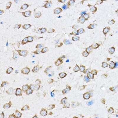 Immunohistochemistry-Paraffin: 60S ribosomal protein L23 Antibody [NBP2-92441] - Immunohistochemistry of paraffin-embedded mouse brain using 60S ribosomal protein L23 Rabbit pAb (NBP2-92441) at dilution of 1:100 (40x lens). Perform high pressure antigen retrieval with 10 mM citrate buffer pH 6.0 before commencing with IHC staining protocol.