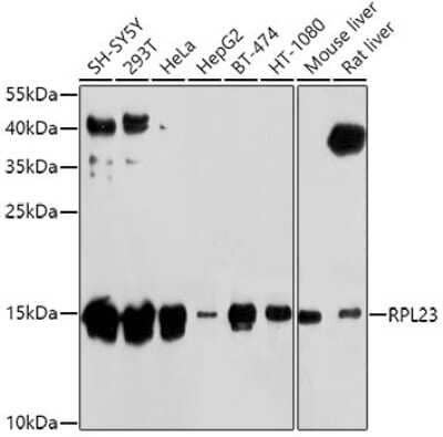 Western Blot: 60S ribosomal protein L23 Antibody [NBP2-92441] - Analysis of extracts of various cell lines, using 60S ribosomal protein L23 at 1:1000 dilution. Secondary antibody: HRP Goat Anti-Rabbit IgG (H+L) at 1:10000 dilution. Lysates/proteins: 25ug per lane. Blocking buffer: 3% nonfat dry milk in TBST. Detection: ECL Basic Kit . Exposure time: 5s.