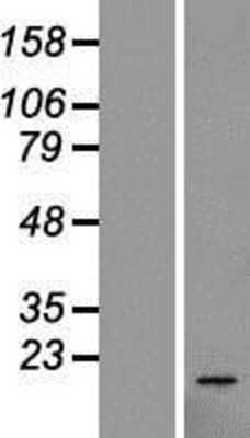 Western Blot: 60S ribosomal protein L23 Overexpression Lysate (Adult Normal) [NBL1-15515] Left-Empty vector transfected control cell lysate (HEK293 cell lysate); Right -Over-expression Lysate for 60S ribosomal protein L23.